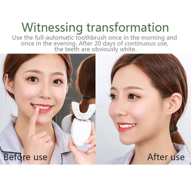 U-Shaped Sonic Electric Toothbrush