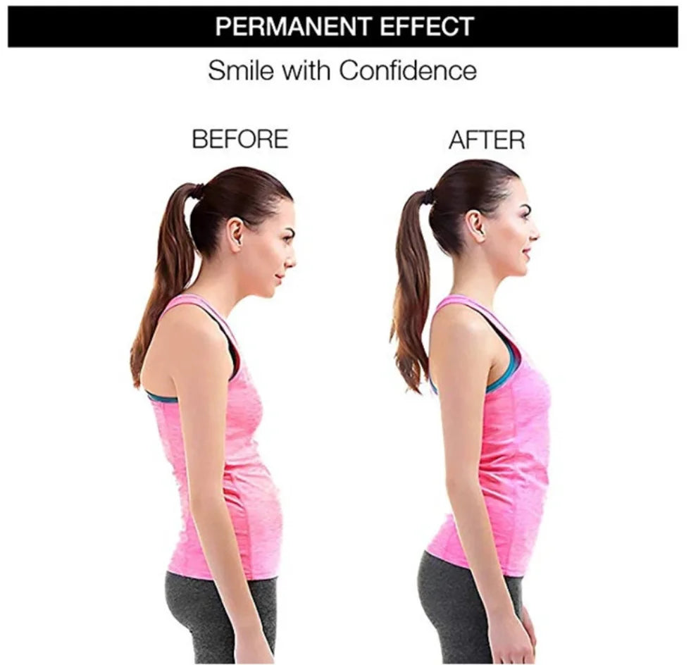 Adjustable Back Posture Corrector Brace